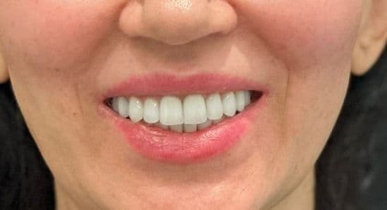 Фото улыбки - Magicneers #1