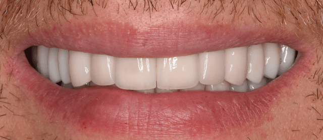 Фото улыбки - Magicneers #2