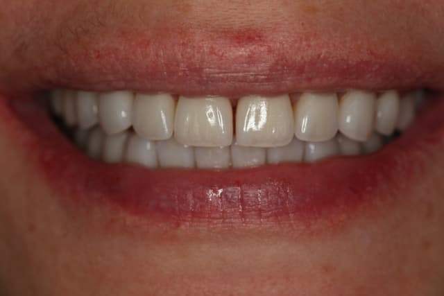 Фото улыбки - Magicneers #3